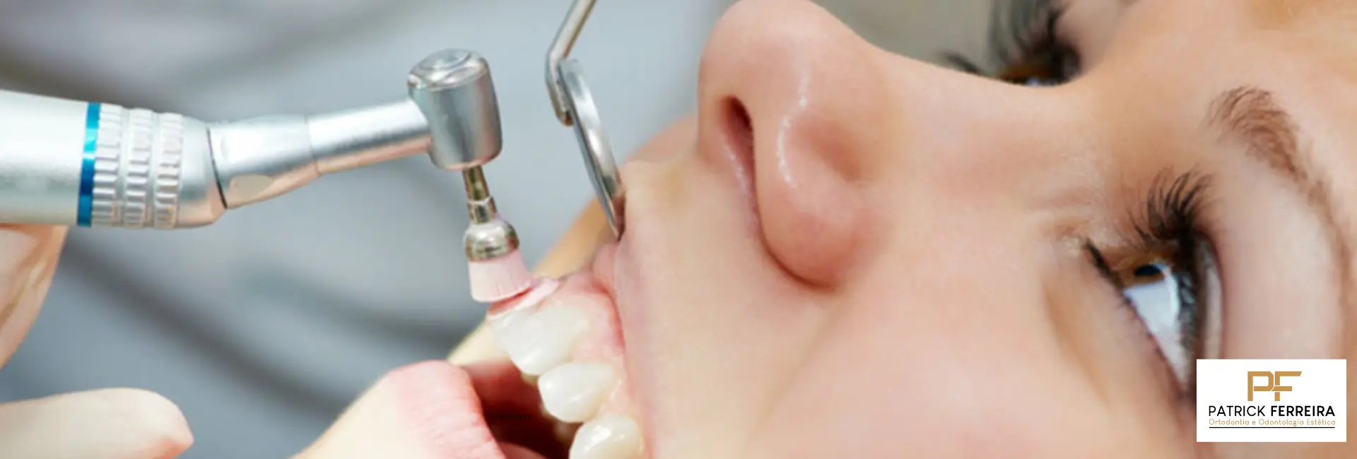 Limpeza Dental Profilática